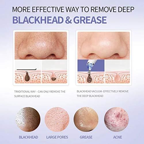 DermaSuction DermaSuction 4 in 1 Multi-function Blackhead Whitehead Extractor Remover Device For Men And Women