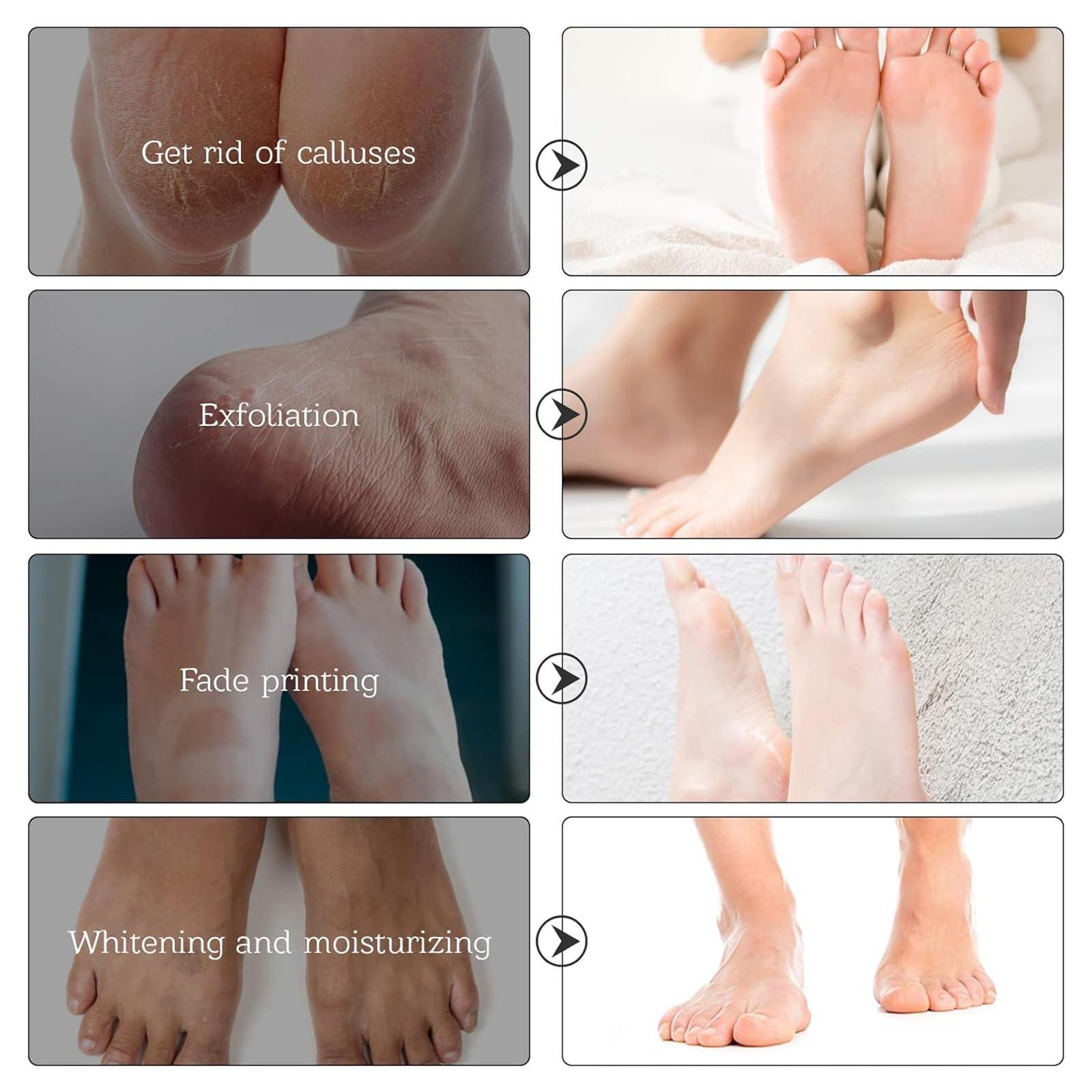 Dr.Pedi Dr.Pedi Foot Peel Mask (5 Pairs) Natural Exfoliator for Dry Dead Skin, Dry, Cracked Feet, Callus, Spa, for Baby Soft Skin Made with Lavender Extract Women and Men Peeling Exfoliating