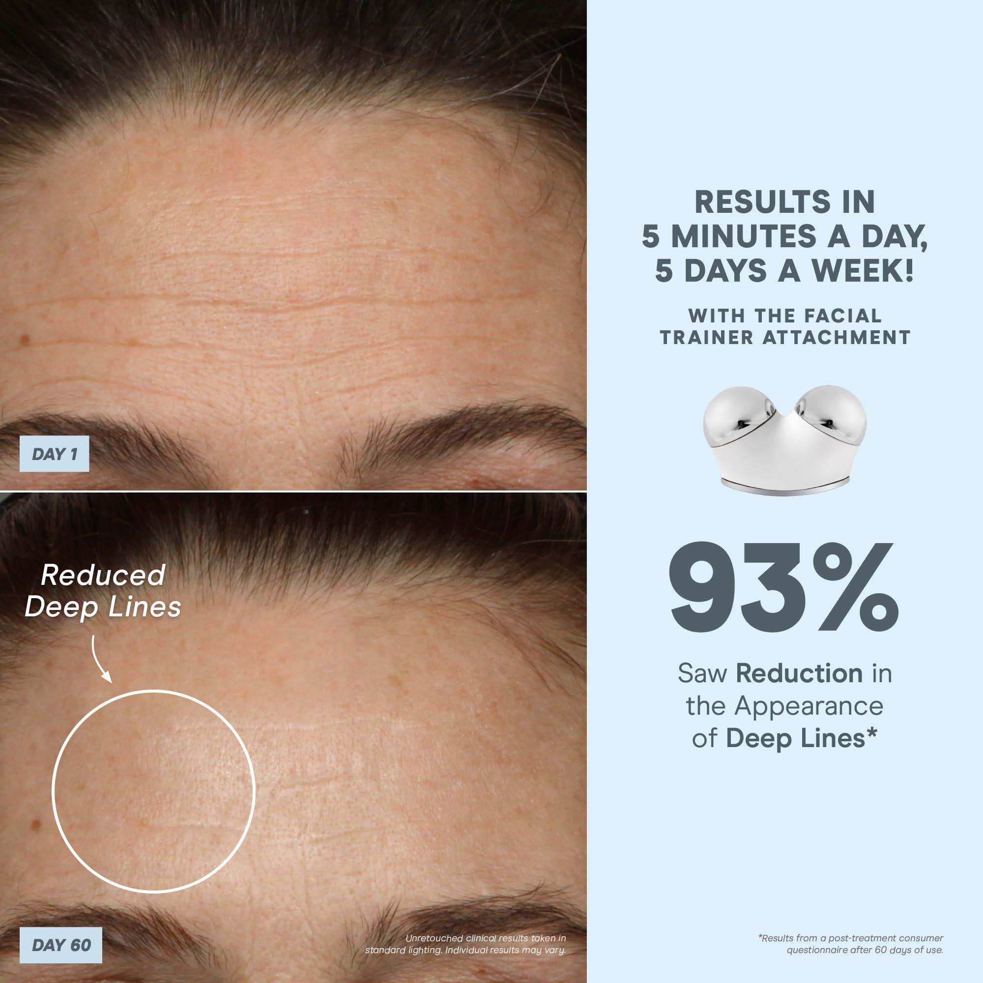 NuFACE NuFACE Trinity+ Microcurrent Facial Device Kit - FDA Cleared Face Sculpting & Neck Tightening Device to Contour Cheeks & Brows + Microcurrent Gel Activator, Silk Crme & Brush