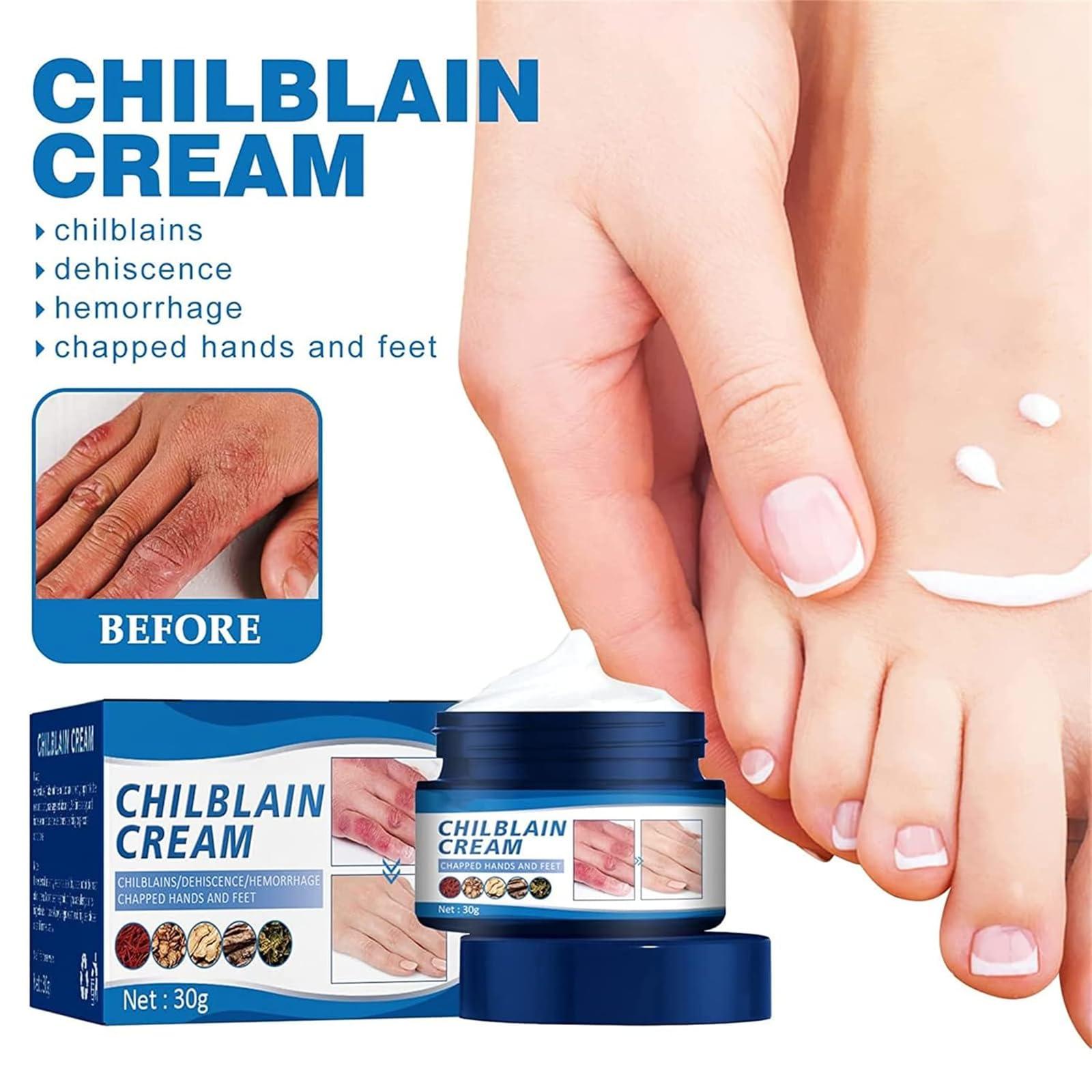 DRXVE DRXVE Chilblain Cream, Anti-cracking Frostbite Moisturiser Deep Nourishing, Anti Crack & Hand Foot Cream, Foot Repair Cream, for Dry Cracked Heels Callus Remover (2 Pc)