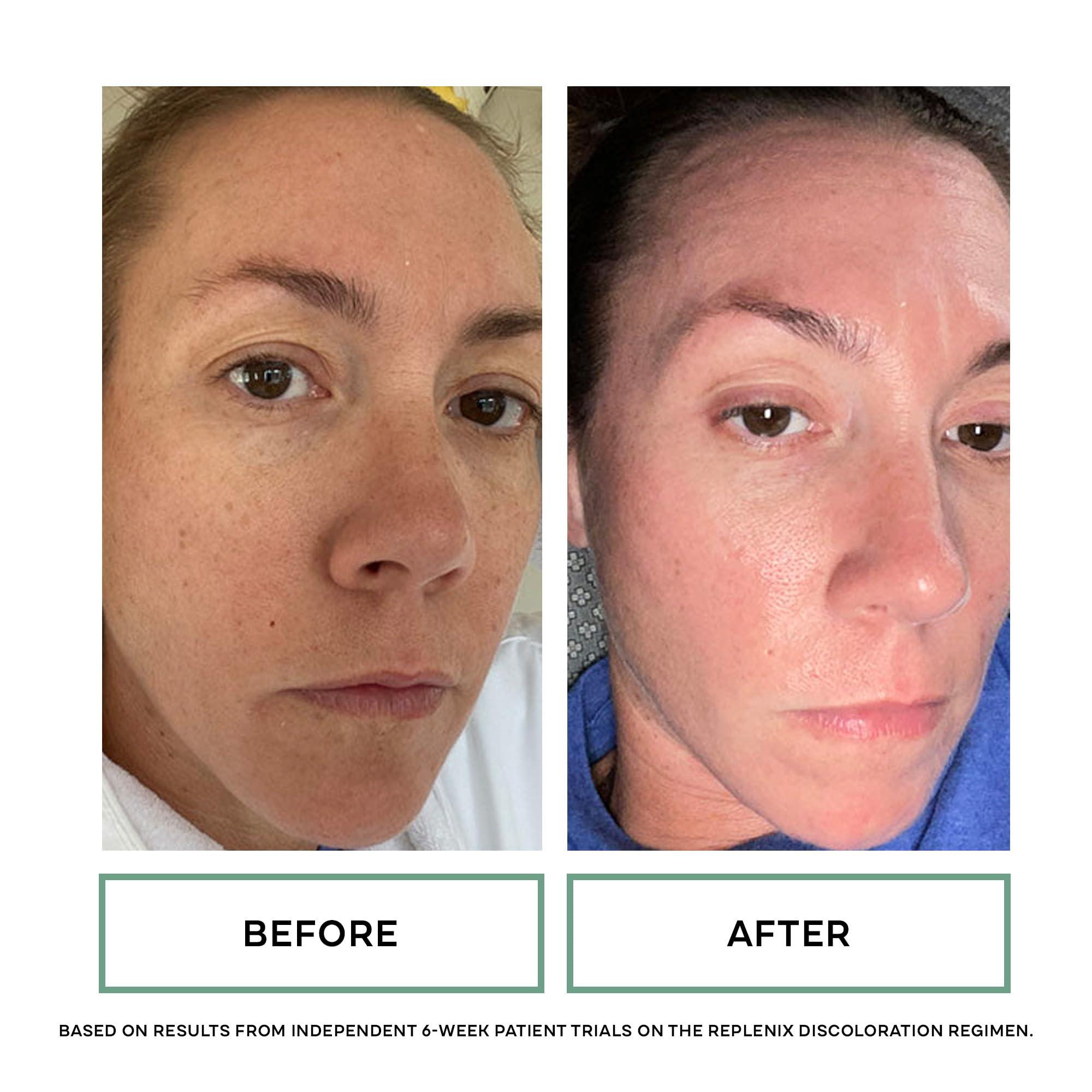 Replenix Replenix Brightening Eye Cream, Medical-Grade Hydrating Under Eye Treatment for Dark Circles & Puffiness with Hyaluronic Acid (0.5 oz)