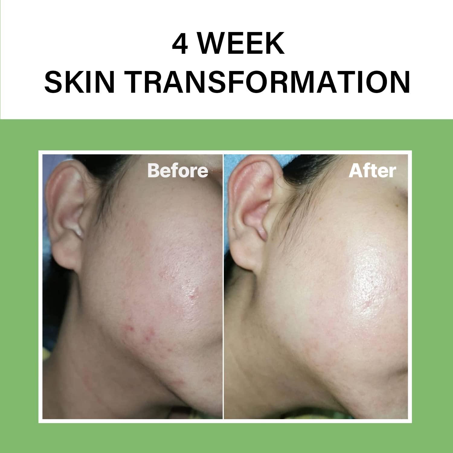 celimax celimax Noni Energy Ampoule 30ml + The Real Noni Energy Repair Cream 50ml + The Real Noni Refresh Clay Mask 120g Bundle