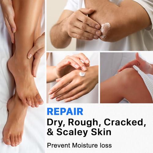 resdam Urea Cream 40%, Keratolytic Foot Cream for Dry Cracked Heels, Feet, Knees, Elbows, Hands, Cuticle, Callus Remover, Skin Barrier Repair (2)