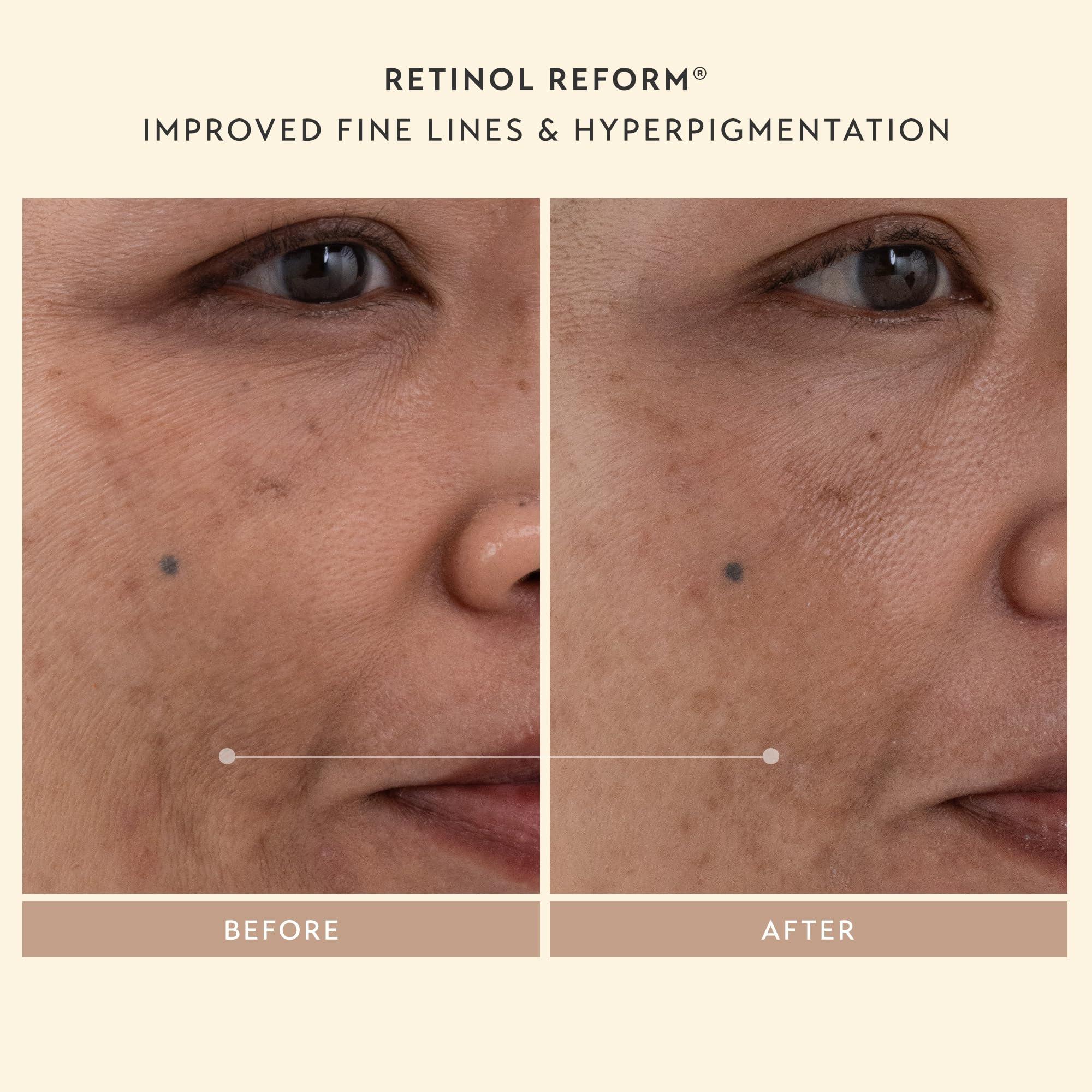 SHANI DARDEN SHANI DARDEN SKIN CARE Sculpt & Firm Travel Kit, Facial Sculpting Wand, Attachments, Retinol Reform & Lactic Serums, Peptide Cream & Pep Gel, 7 Items