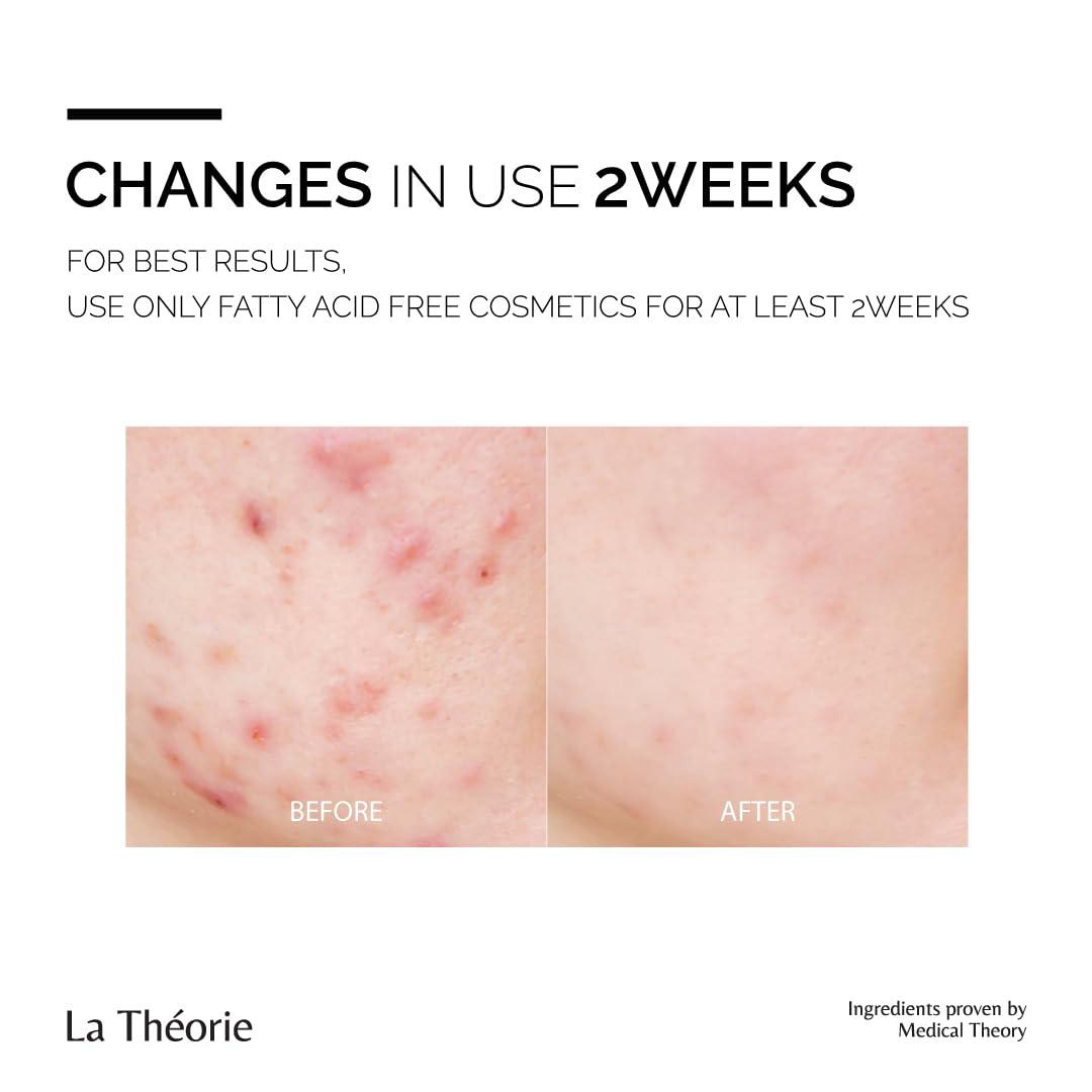 La Theorie La Theorie Cleanser Clearing Gel for troubled skin with fungal and small bumps (Fatty acid Free, 7.10 Fl Oz)