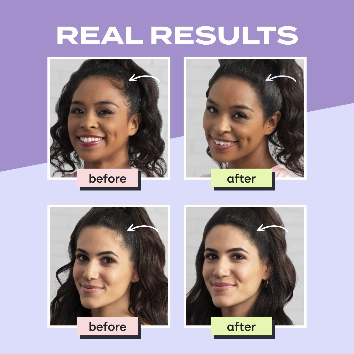 Toppik Hair Filler Toppik Hair Filler Keratin Hair Fiber Powder 12g - Hair Thickener for Women, Camoflauge Roots, Fills Hairline Gaps For Fuller Hair - Dark Brown