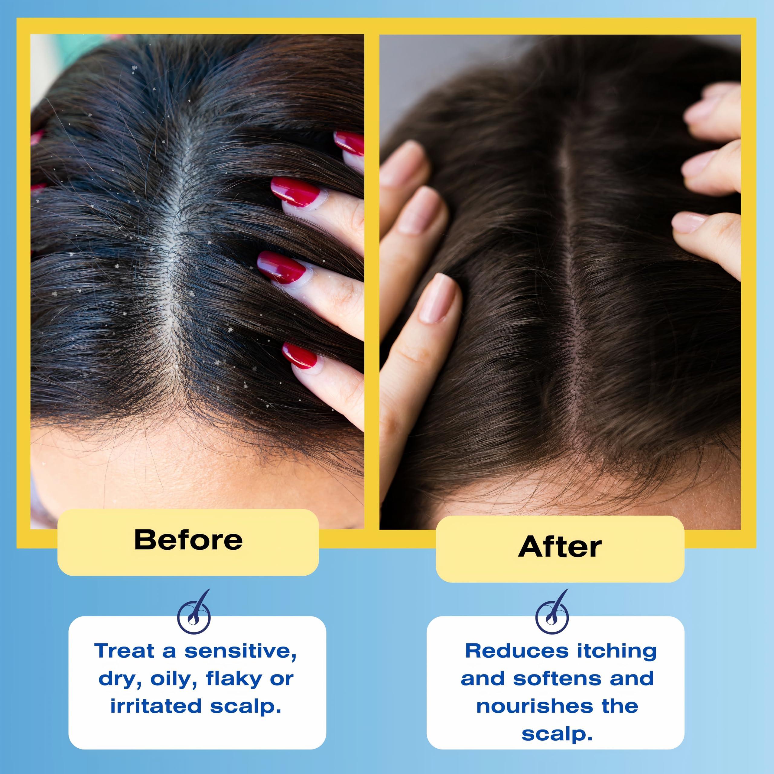 Therapro MEDIceuticals Mediceuticals Therapeutic Conditioner  All Skin Types  Sensitive Dry Scalp  Oily Scalp - Reduces Itching - Flaky Scalp 8.45oz (250ml)