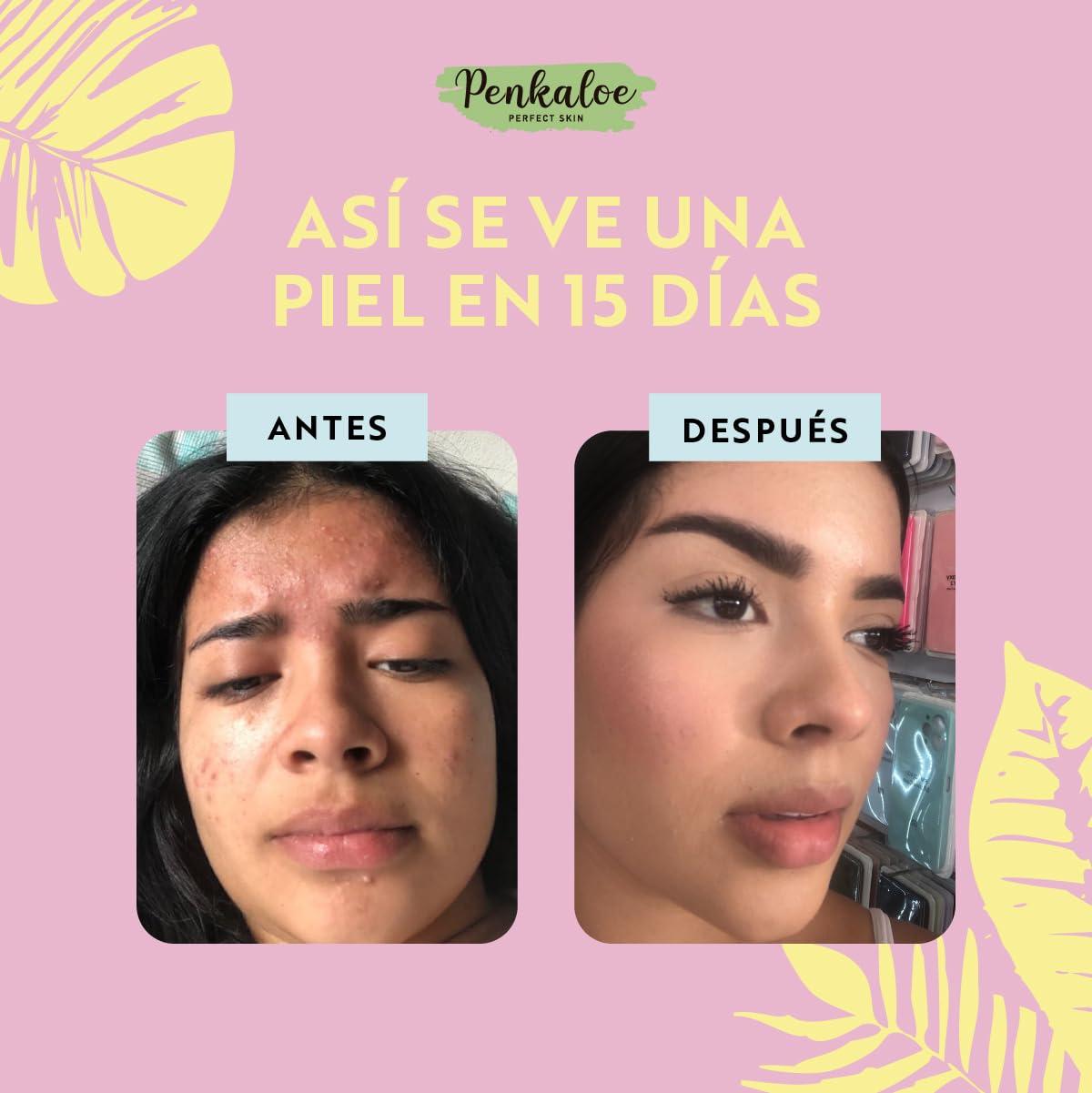 NinthAvenue Basics Penkaloe Gel de Aloe Vera con Niacinamida y cido Hialurnico, 4 oz | Hidrata, Calma y Mejora el Tono | Hydrates, Soothes & Improves Skin Tone | Controla Grasa y Regenera | Controls Oil & Regenerates