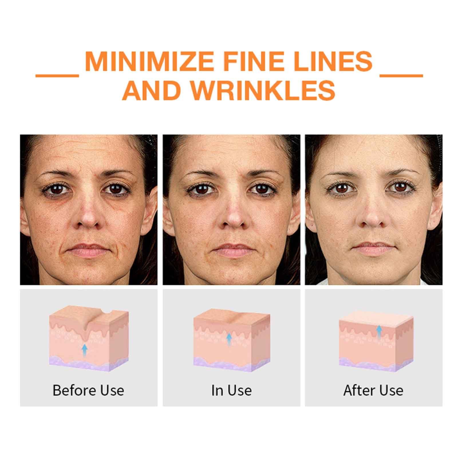 Elegacell ElegaCell Super Vitamin C Serum for Women Over 70 - Advanced Anti-Aging Vitamin C Face Serum,Super Vitamin C Penetrating Serum for Mature Skin, All-in-One Formula 1.69 fl oz